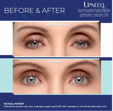 Load image into Gallery viewer, Upneeq